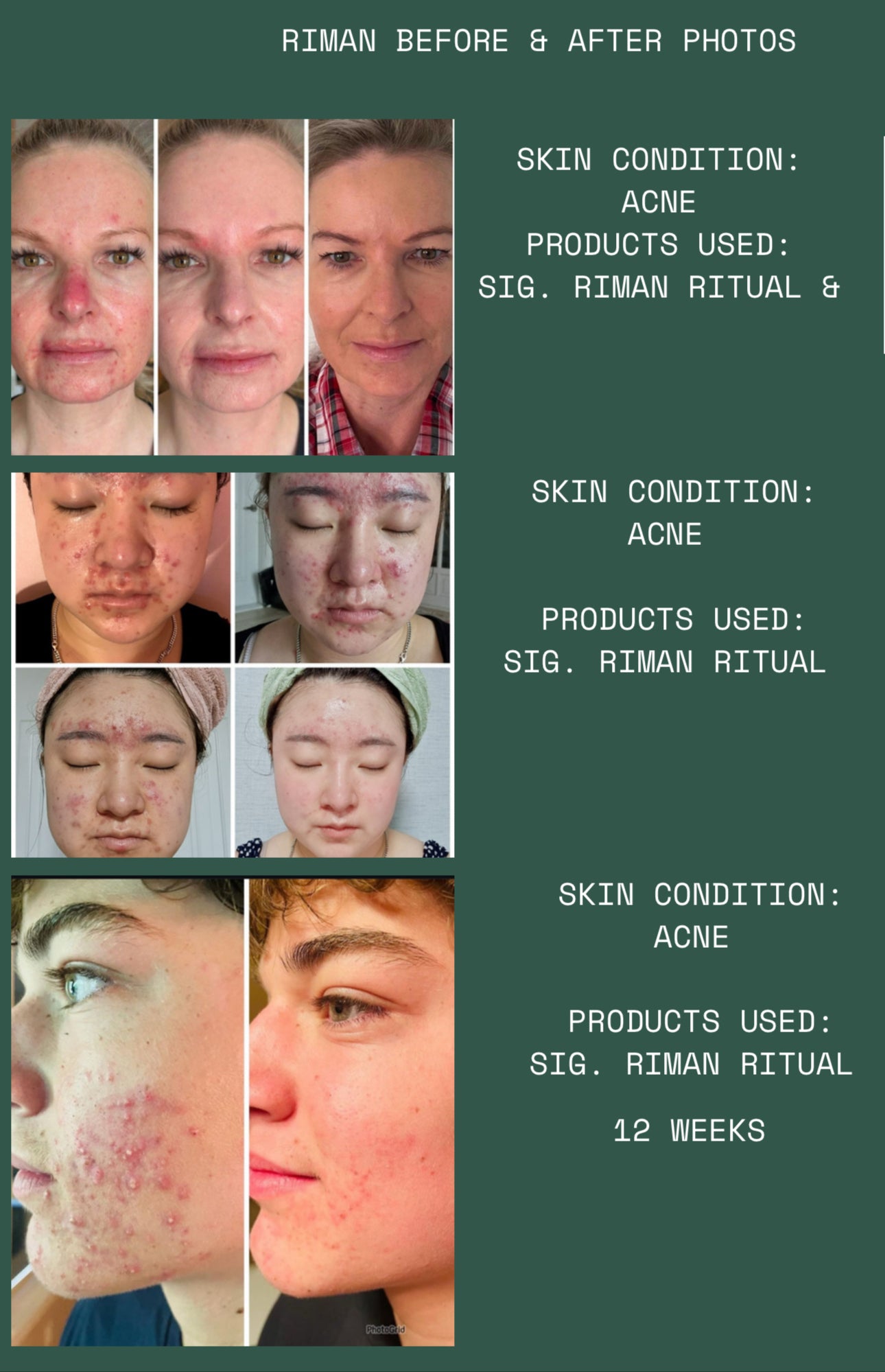 Before and after photos of a person's skin condition improvement using a Riman ritual.