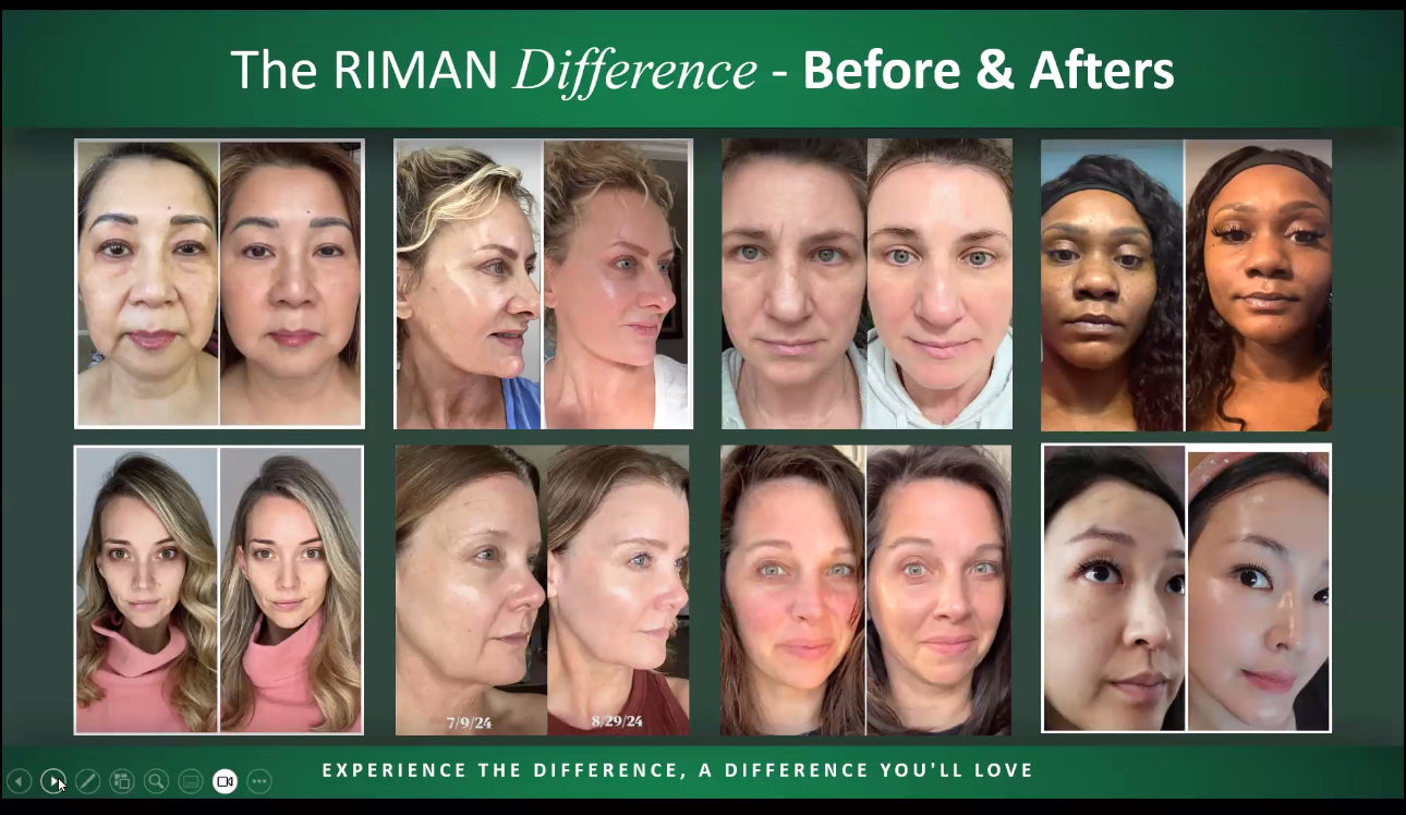 Before and after comparison of facial treatments with 'The RIMAN Difference' text at the top.